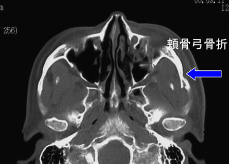 �˹�����